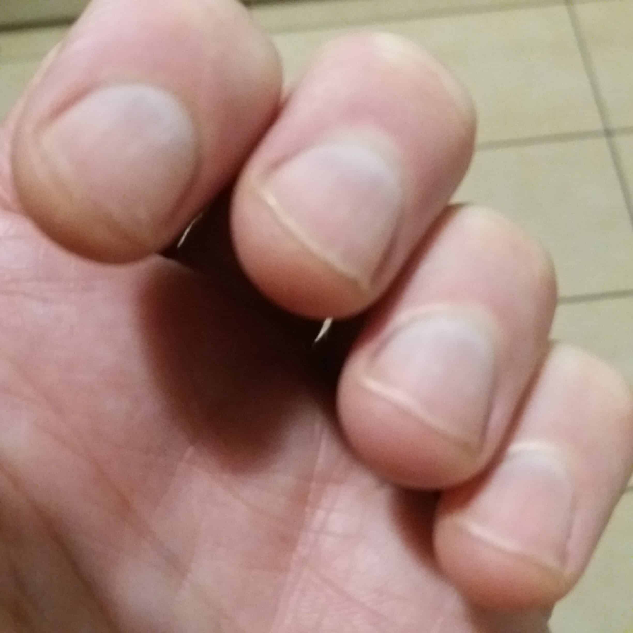My fingernails after I stopped biting them