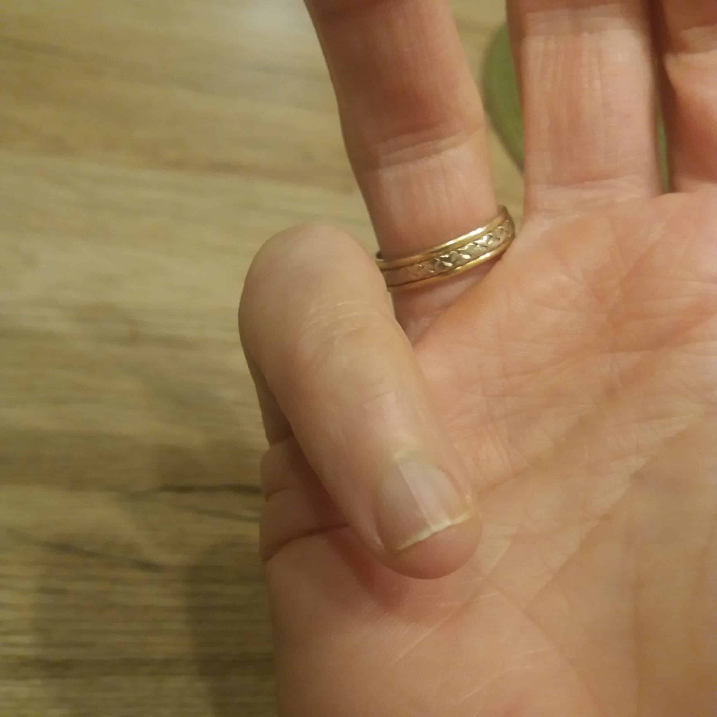 Split baby fingernail